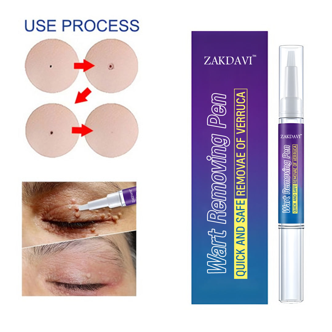 Zakdaviβ’ Warts Remover Original Cream β Fast, Safe & Effective Skin Solution ππ‘οΈ