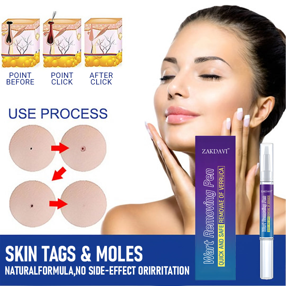 Zakdaviβ’ Warts Remover Original Cream β Fast, Safe & Effective Skin Solution ππ‘οΈ