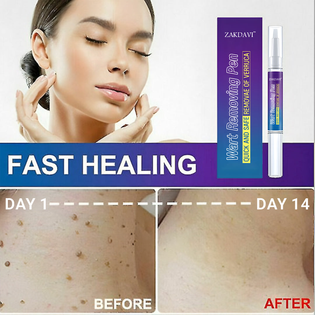 Zakdavi™ Warts Remover Original Cream – Fast, Safe & Effective Skin Solution 🌟🛡️