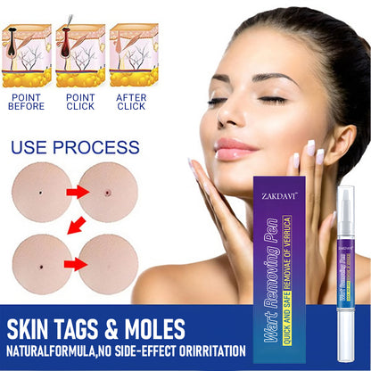Zakdavi™ Warts Remover Original Cream – Fast, Safe & Effective Skin Solution 🌟🛡️